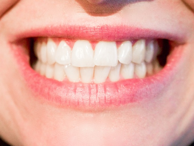 How Long Does a Smile Makeover with Veneers or Crowns Actually Take?