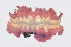 mouth scan