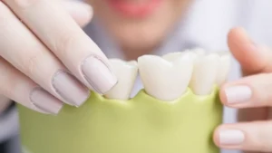 Replacing old dental crowns