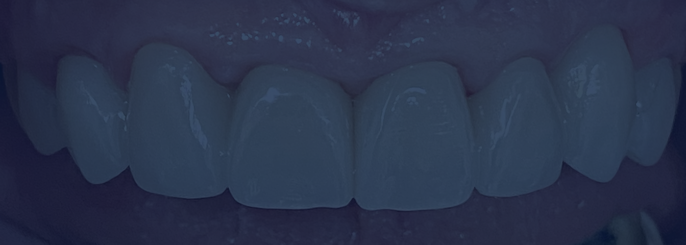 How to Choose the Right Dentist in Riverview, FL