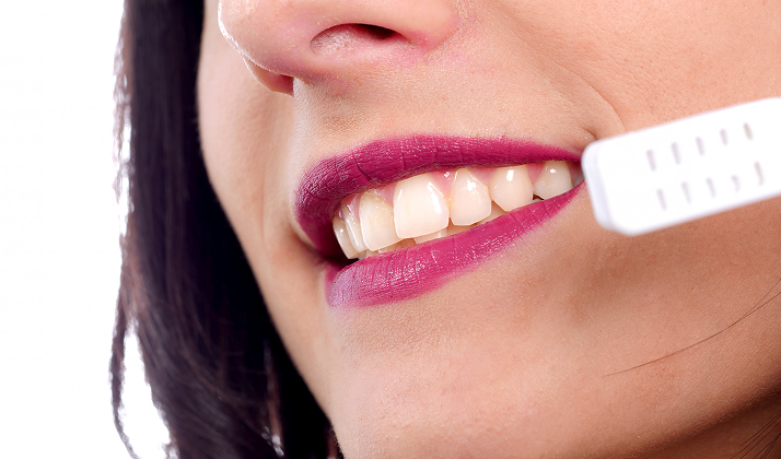 Gum Recontouring Before Veneers: The Missing Step in Smile Makeovers