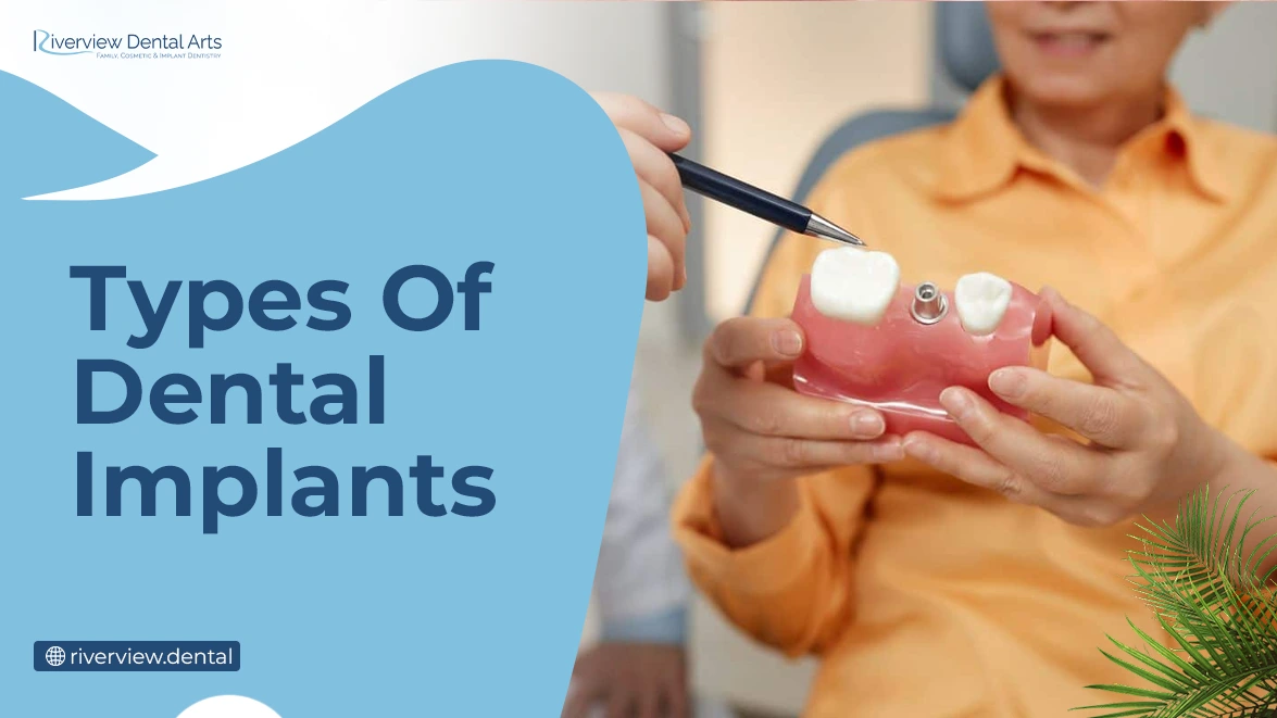 Types Of Dental Implants