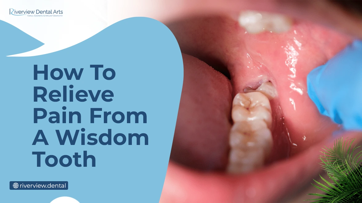 How To Relieve Pain From A Wisdom Tooth