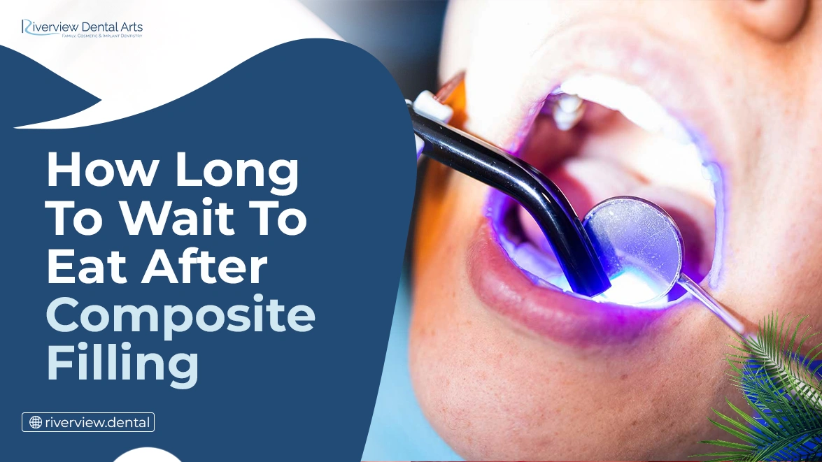 How Long To Wait To Eat After A Composite Filling
