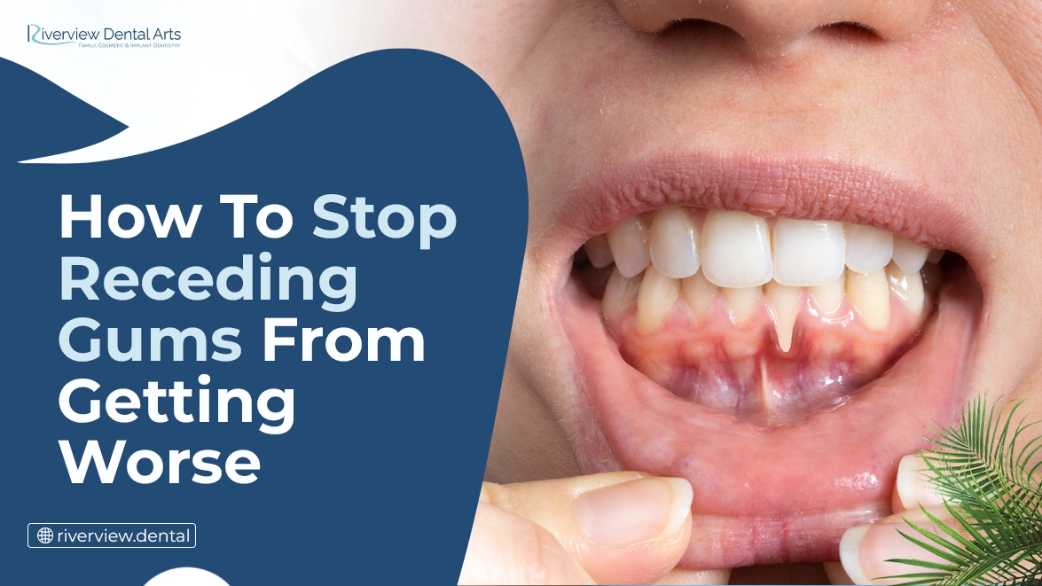 How to Stop Receding Gums From Getting Worse