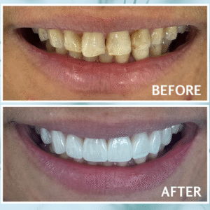 Dangers of Kissing for Oral Health: How to Protect Your Smile