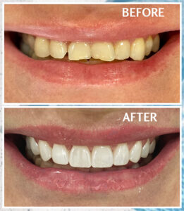 после для сайта14 1