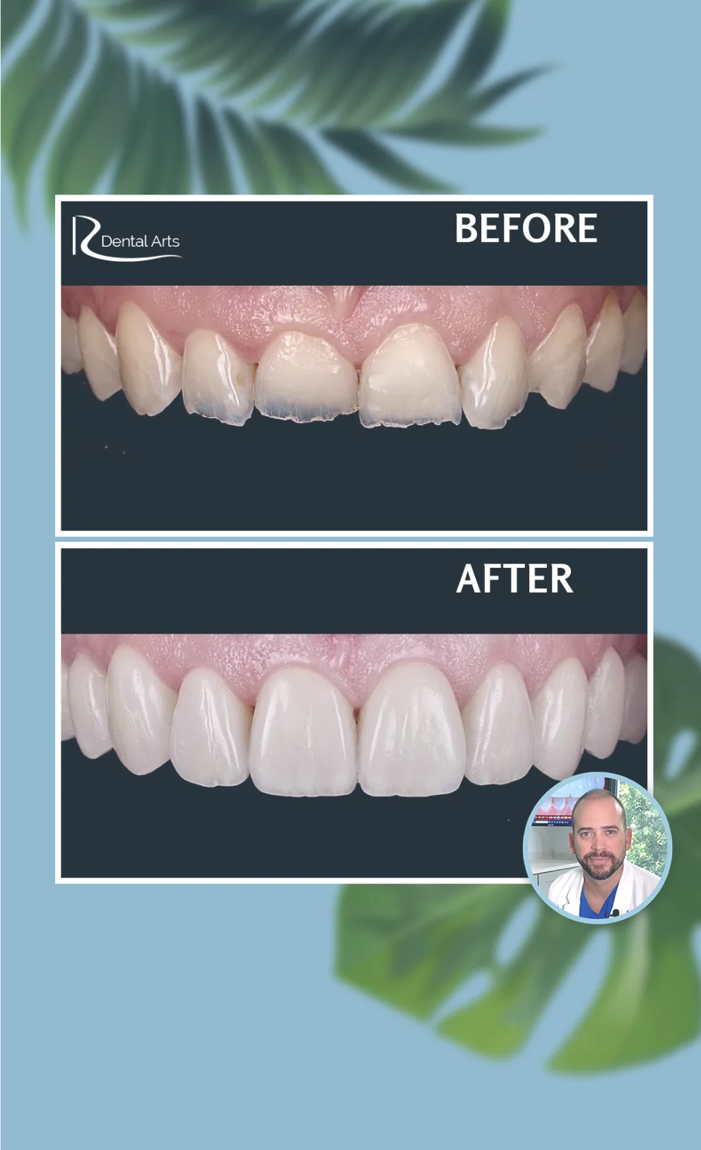 Benefits of Choosing a Local Dentist in Riverview for Your Oral Health